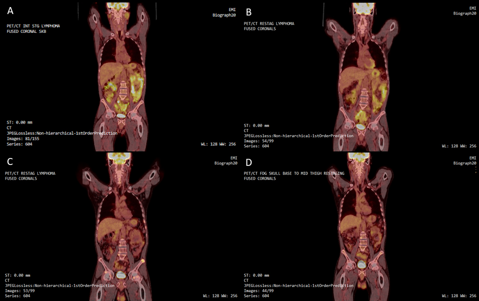 X-rays